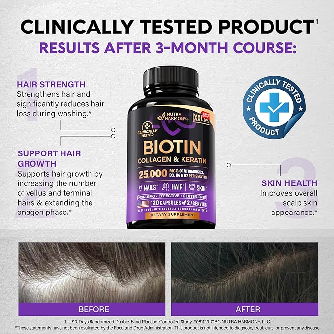 Biotin | Collagen | Hyaluronic Acid | Keratin - Clinically Tested Supplement - Hair Growth Support Skin &amp Nails - 25000 mcg Vitamins B2 B3 B6 &amp B7 + B1 - Made in USA - Women &amp Men | 120
