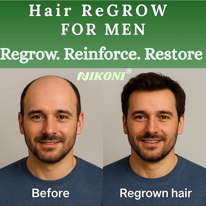 Nikoni Hair ReGROW for Men – Liposomal Hair Support Liposomal Formula with Biotin Keratin Saw Palmetto &amp Essential Nutrients-60 Vegan Softgels