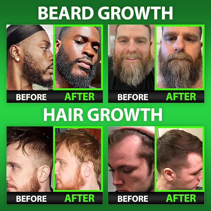 Beard Growth Kit w/Grow XXL Beard Oil/Facial Hair Serum for Men + 14-in-1 BIOTIN Gummies/Hair Growth Vitamins for Men + 6X Liquid Biotin with Collagen Peptides - Formulated in America