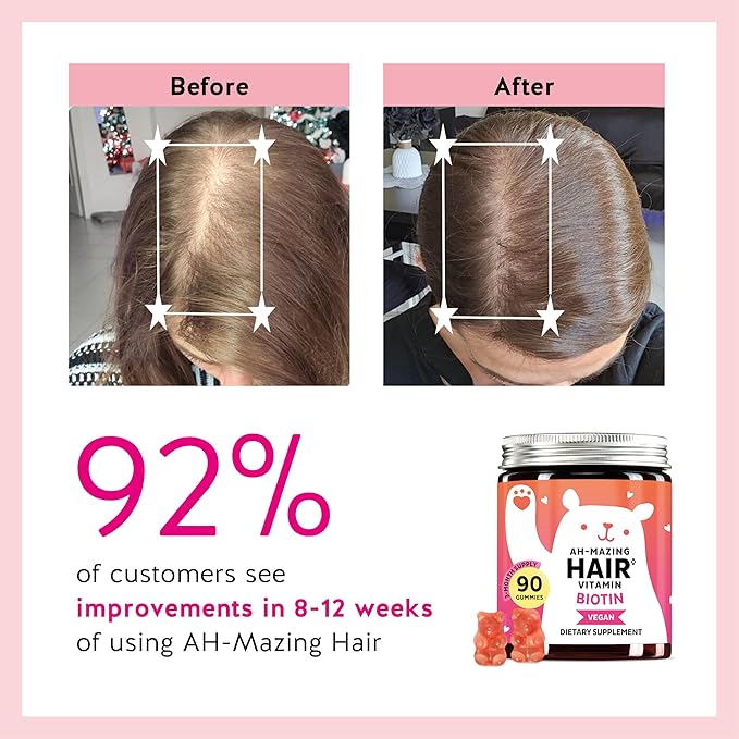 Biotin Gummies for Hair Skin &amp Nails. 5000 mcg High Potency Vegan Vitamins for Faster Hair Growth Stronger Nails &amp Healthy Skin. with Vitamins C &amp E 60 Gummies