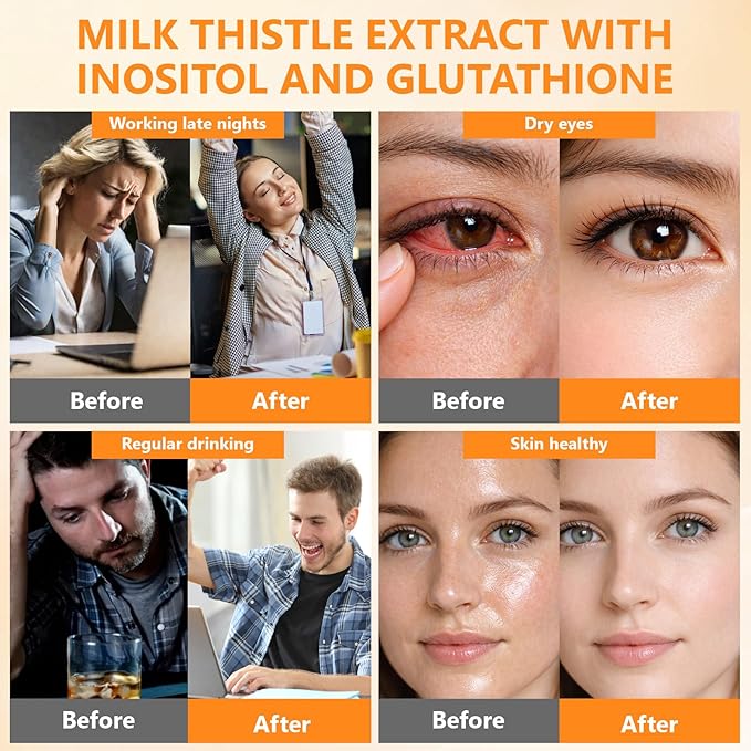 Liver Cleanse Detox for Women: Milk Thistle with Dandelion for Liver Support Inositol &amp Glutathione for Antioxidant Metabolic Health Non-GMO 60 Capsules