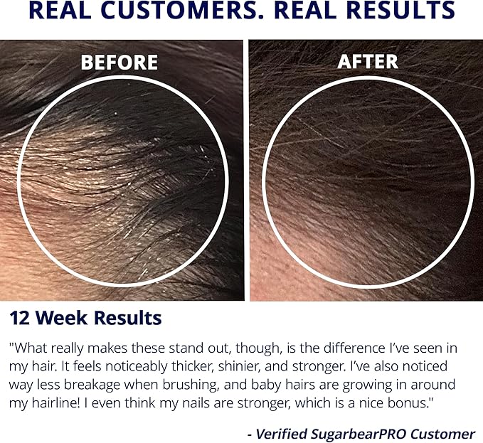 SugarBearPro Hair Vitamin Gummy 3 Month Supply Extra Strength Biotin 6000mcg Growth for Men &amp Women Vegan Vitamin B12 MSM Inositol Omega 3 Elderberry Certified Kosher Halal Cruelty-Free