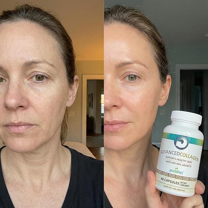 Hydrolyzed Collagen Capsules for Women – Hair Skin Nails &amp Joint Support – Advanced Collagen Supplement – 90 Capsules | Colágeno Hidrolizado para Mujer