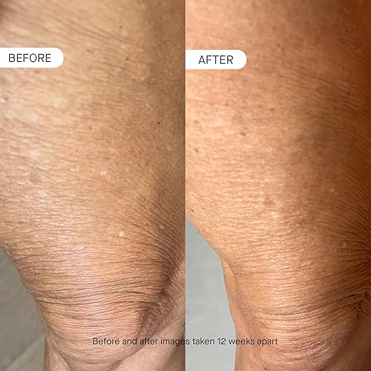 OneSkin BODY OS-01 Peptide Topical Supplement &amp Skin Longevity Age Reversal Moisturizer | Safe for Sensitive Skin Fragrance-Free 60 mL / 2 oz