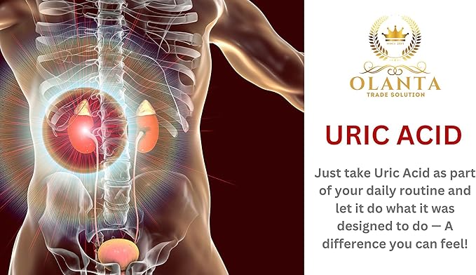 Generic Premium uric Acid Support Supplement - URIC Acid Support Formula - Tart Cherry Capsules Lower uric Acid Supplement Herbal Uric Acid Milk Thistle - 2 Bottles
