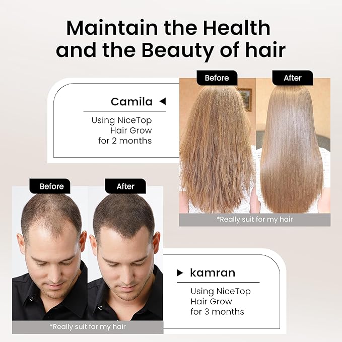 Hair Growth Supplement Hair Care Support for Strength Thickness Growth with Biotin Vitamin A C E Zinc 60 Capsules
