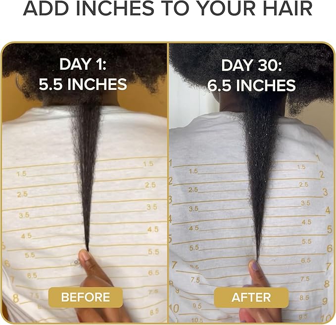 Shedavi Iconic Natural Hair Vitamins for Fast Hair Growth - Pure Hair Supplements Formulated with Vitamins to Promote Thicker Stronger Hair - Vegan Hair Care for Hair Loss - Non-GMO (60 Capsules)
