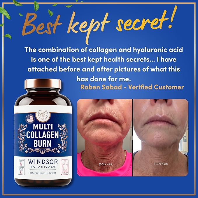 Thermogenic Multi Collagen Burn Capsules - Hydrolyzed Multi Collagen Complex Types I II III V X Marine Collagen Hyaluronic Acid - Beauty and Anti-Aging Supplement for Women and Men - 180 Pills