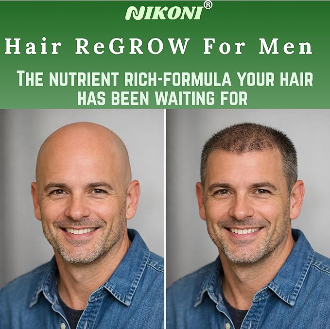 Nikoni Hair ReGROW for Men – Liposomal Hair Support Liposomal Formula with Biotin Keratin Saw Palmetto &amp Essential Nutrients-60 Vegan Softgels