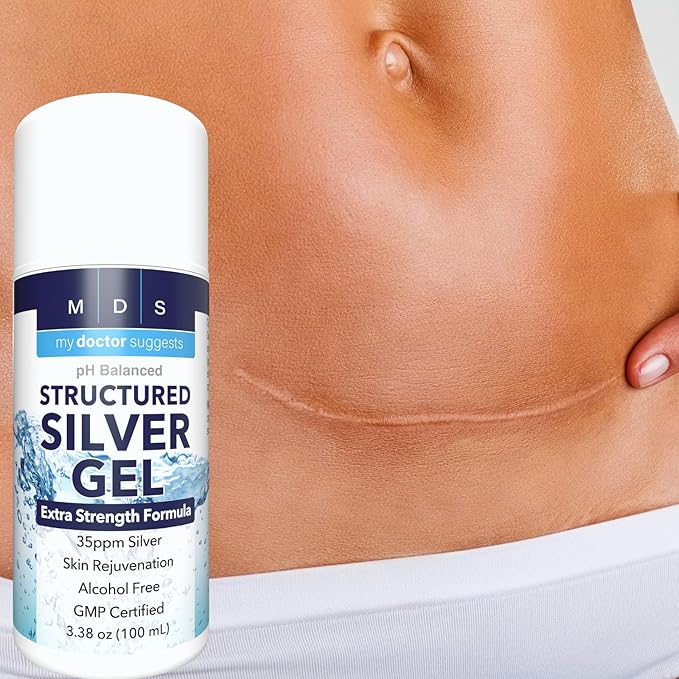 Structured Colloidal Silver Gel Extra Strength - Topical Cooling - pH Balanced 35ppm Structured Silver Provides Soothing Relief of Burns &amp Skin Irritations