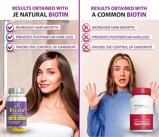 JE Natural Biotin Hair Skin and Nails Vitamins Vitamin C Biotin and Collagen Supplements That Make Hair Grow Faster and Longer for All Ages 60 Capsules of Biotin 20000mcg Maximum Strength.